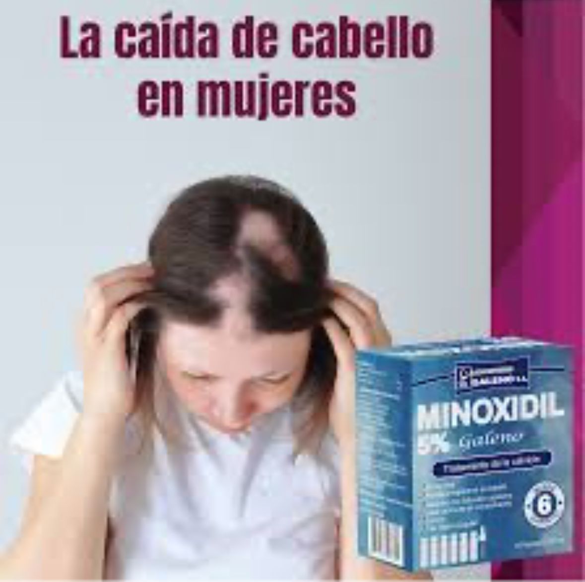 SOLUCION TOPICO PARA CRECIMIENTO DE PELO